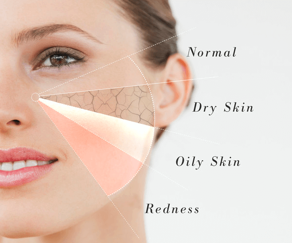 Unlocking the Secret to Radiant Skin: The Importance of Knowing Your Skin Type